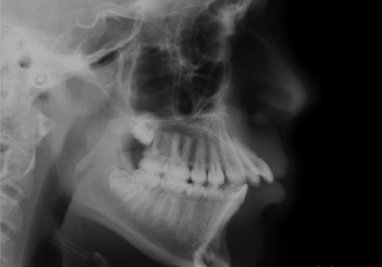 terms-cephalometric.jpg